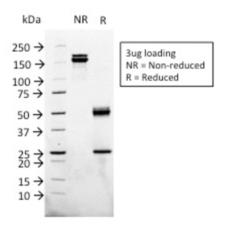 SDS-PAGE - Anti-Glypican 3 Antibody [1G12] - BSA and Azide free (A251909) - Antibodies.com