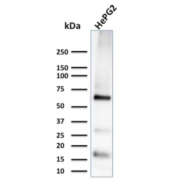 Western Blot - Anti-Glypican 3 Antibody [1G12] - BSA and Azide free (A251909) - Antibodies.com