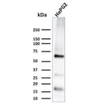 Western Blot - Anti-Glypican 3 Antibody [1G12] - BSA and Azide free (A251909) - Antibodies.com