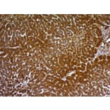 Immunohistochemistry - Anti-Glypican 3 Antibody [GPC3/863] - BSA and Azide free (A251911) - Antibodies.com