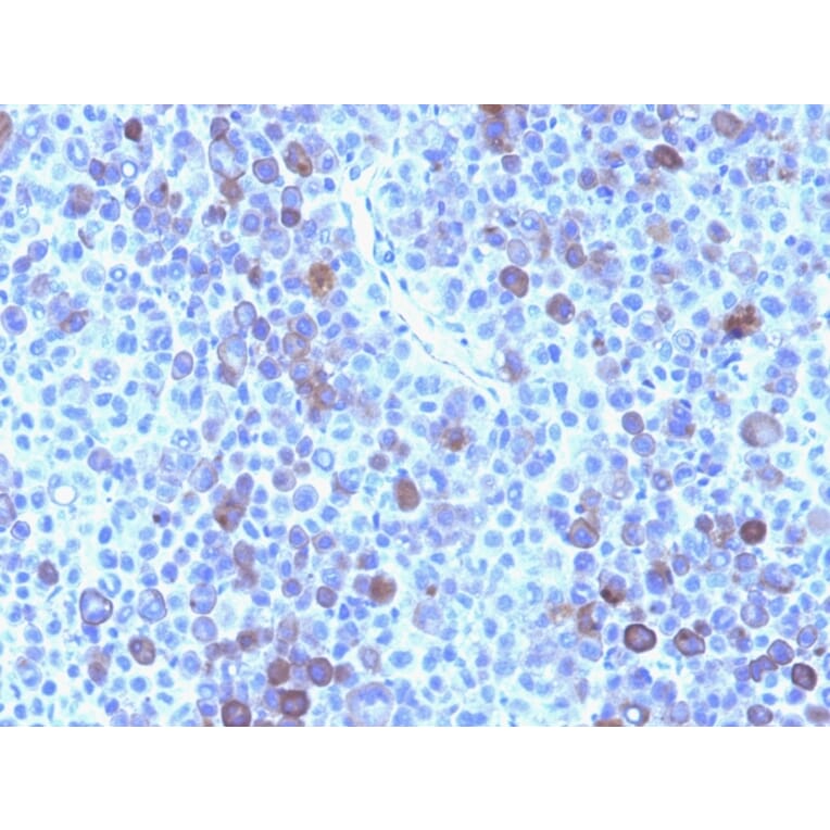 Immunohistochemistry - Anti-Glypican 3 Antibody [GPC3/863] - BSA and Azide free (A251911) - Antibodies.com
