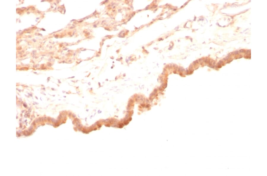 Immunohistochemistry - Anti-Glypican 3 Antibody [GPC3/863] - BSA and Azide free (A251911) - Antibodies.com