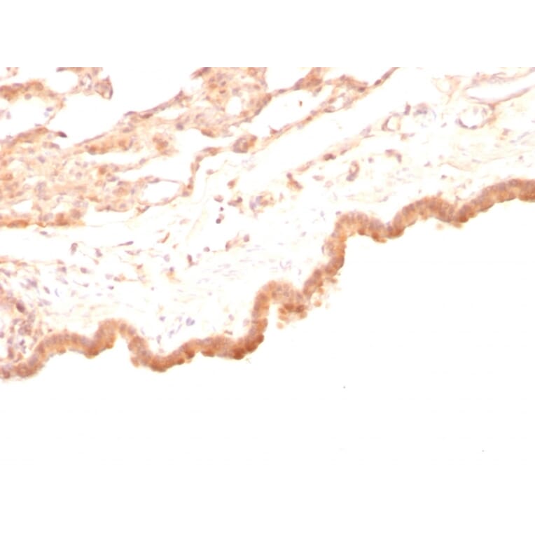 Immunohistochemistry - Anti-Glypican 3 Antibody [GPC3/863] - BSA and Azide free (A251911) - Antibodies.com