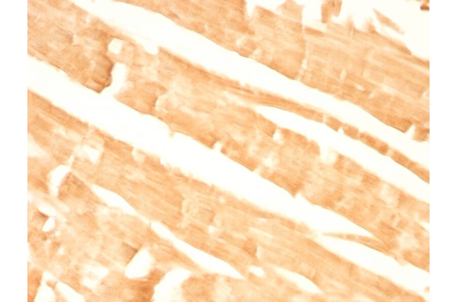 Immunohistochemistry - Anti-Glypican 3 Antibody [GPC3/863] - BSA and Azide free (A251911) - Antibodies.com