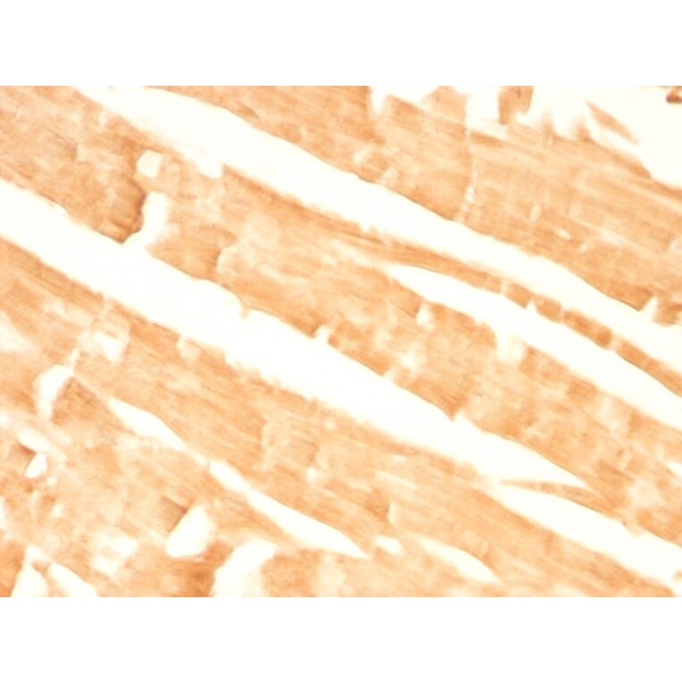 Immunohistochemistry - Anti-Glypican 3 Antibody [GPC3/863] - BSA and Azide free (A251911) - Antibodies.com