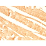 Immunohistochemistry - Anti-Glypican 3 Antibody [GPC3/863] - BSA and Azide free (A251911) - Antibodies.com