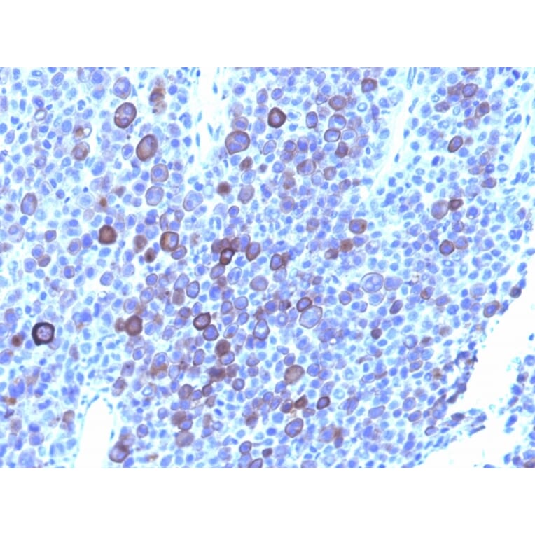 Immunohistochemistry - Anti-Glypican 3 Antibody [1G12 + GPC3/863] - BSA and Azide free (A251912) - Antibodies.com