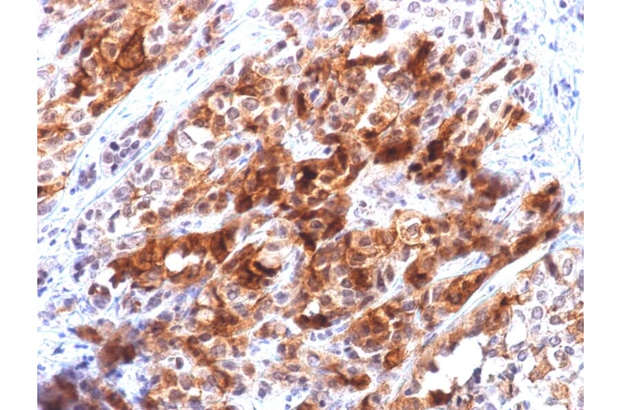Immunohistochemistry - Anti-Glypican 3 Antibody [rGPC3/863] - BSA and Azide free (A251913) - Antibodies.com