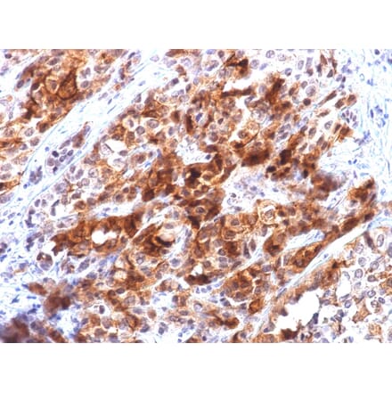 Immunohistochemistry - Anti-Glypican 3 Antibody [rGPC3/863] - BSA and Azide free (A251913) - Antibodies.com