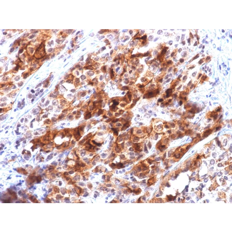 Immunohistochemistry - Anti-Glypican 3 Antibody [rGPC3/863] - BSA and Azide free (A251913) - Antibodies.com