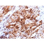 Immunohistochemistry - Anti-Glypican 3 Antibody [rGPC3/863] - BSA and Azide free (A251913) - Antibodies.com