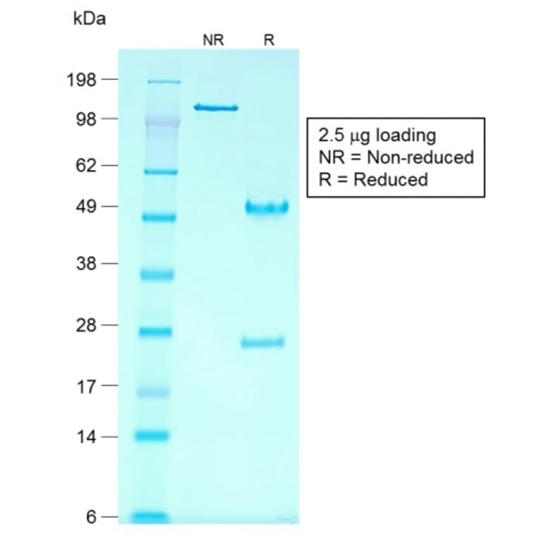 SDS-PAGE - Anti-Glypican 3 Antibody [rGPC3/863] - BSA and Azide free (A251913) - Antibodies.com