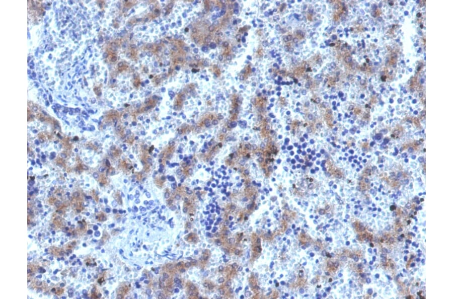 Immunohistochemistry - Anti-Glypican 3 Antibody [GPC3/1534R] - BSA and Azide free (A251914) - Antibodies.com