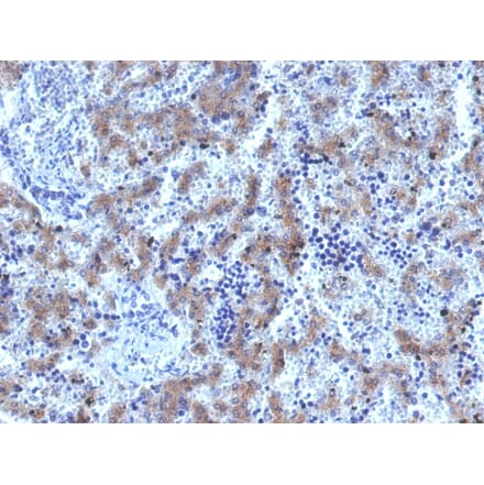 Immunohistochemistry - Anti-Glypican 3 Antibody [GPC3/1534R] - BSA and Azide free (A251914) - Antibodies.com