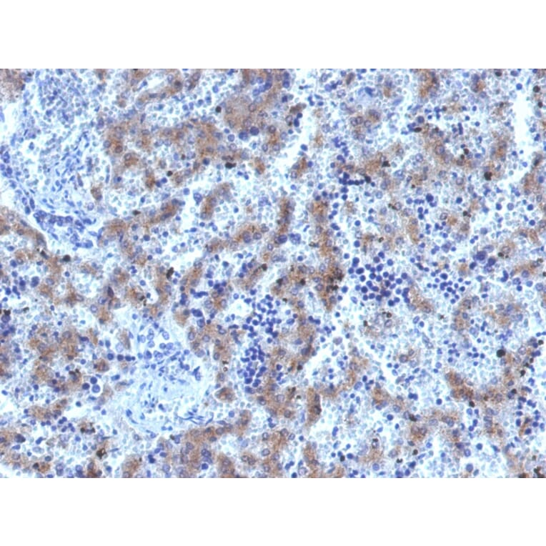 Immunohistochemistry - Anti-Glypican 3 Antibody [GPC3/1534R] - BSA and Azide free (A251914) - Antibodies.com