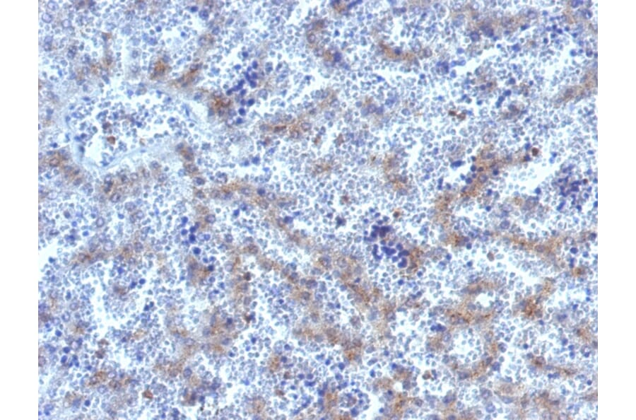 Immunohistochemistry - Anti-Glypican 3 Antibody - BSA and Azide free (A251914) - Antibodies.com