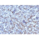 Immunohistochemistry - Anti-Glypican 3 Antibody - BSA and Azide free (A251914) - Antibodies.com