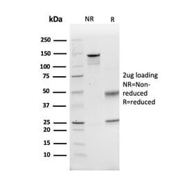 SDS-PAGE - Anti-GCLM Antibody [CPTC-GCLM-1] - BSA and Azide free (A251917) - Antibodies.com