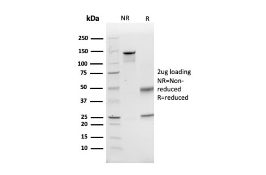 SDS-PAGE - Anti-GCLM Antibody [CPTC-GCLM-1] - BSA and Azide free (A251917) - Antibodies.com