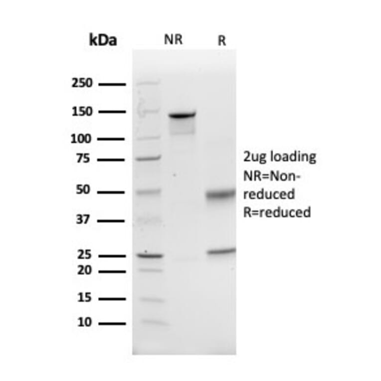 SDS-PAGE - Anti-GCLM Antibody [CPTC-GCLM-1] - BSA and Azide free (A251917) - Antibodies.com