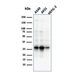 Western Blot - Anti-GCLM Antibody [CPTC-GCLM-1] - BSA and Azide free (A251917) - Antibodies.com