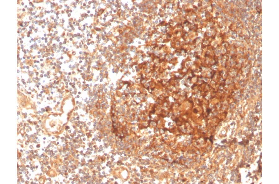 Immunohistochemistry - Anti-GCLM Antibody [CPTC-GCLM-1] - BSA and Azide free (A251917) - Antibodies.com