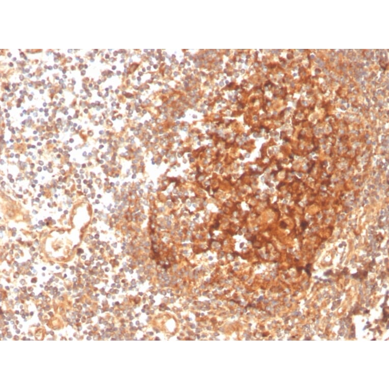 Immunohistochemistry - Anti-GCLM Antibody [CPTC-GCLM-1] - BSA and Azide free (A251917) - Antibodies.com