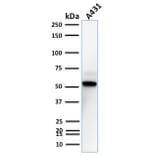 Western Blot - Anti-TOX3 Antibody [TOX3/1123] - BSA and Azide free (A251918) - Antibodies.com
