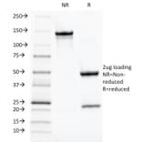 SDS-PAGE - Anti-TOX3 Antibody [TOX3/1124] - BSA and Azide free (A251918) - Antibodies.com