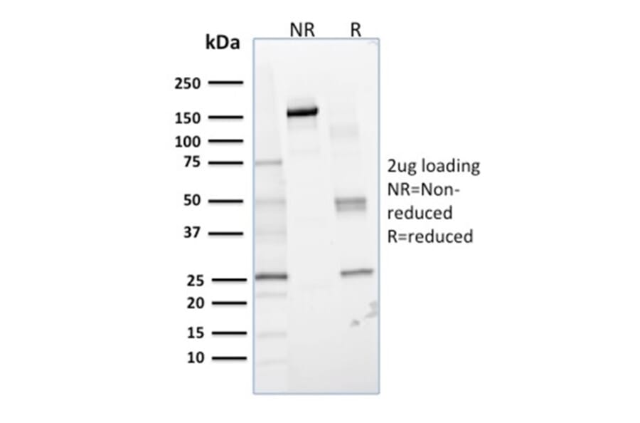 SDS-PAGE - Anti-Glyoxalase 1 Antibody [CPTC-GLO1-1] - BSA and Azide free (A248739) - Antibodies.com