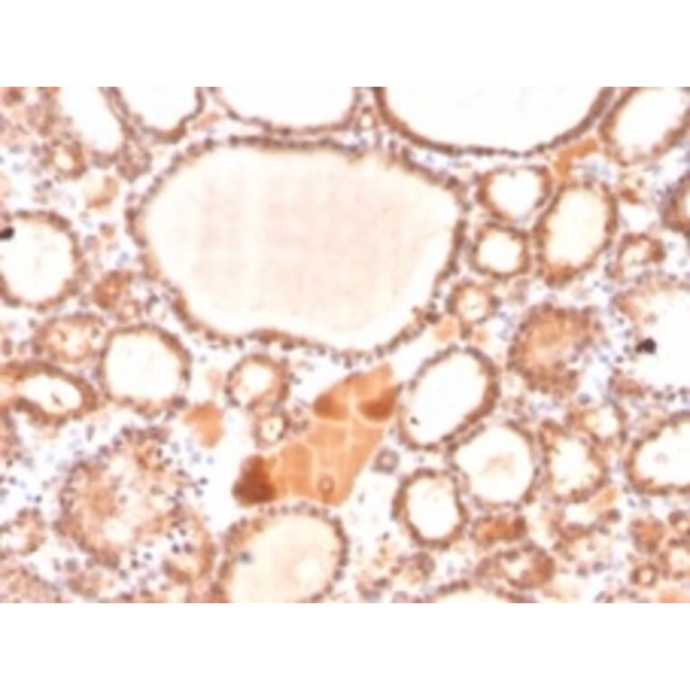 Immunohistochemistry - Anti-Glyoxalase 1 Antibody [CPTC-GLO1-1] - BSA and Azide free (A248739) - Antibodies.com