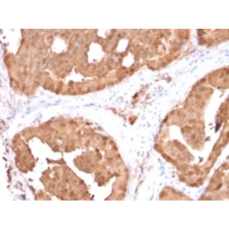 Immunohistochemistry - Anti-Glyoxalase 1 Antibody [CPTC-GLO1-1] - BSA and Azide free (A248739) - Antibodies.com
