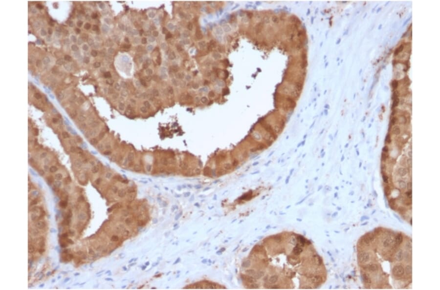 Immunohistochemistry - Anti-Glyoxalase 1 Antibody [CPTC-GLO1-3] - BSA and Azide free (A251921) - Antibodies.com