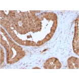 Immunohistochemistry - Anti-Glyoxalase 1 Antibody [CPTC-GLO1-3] - BSA and Azide free (A251921) - Antibodies.com