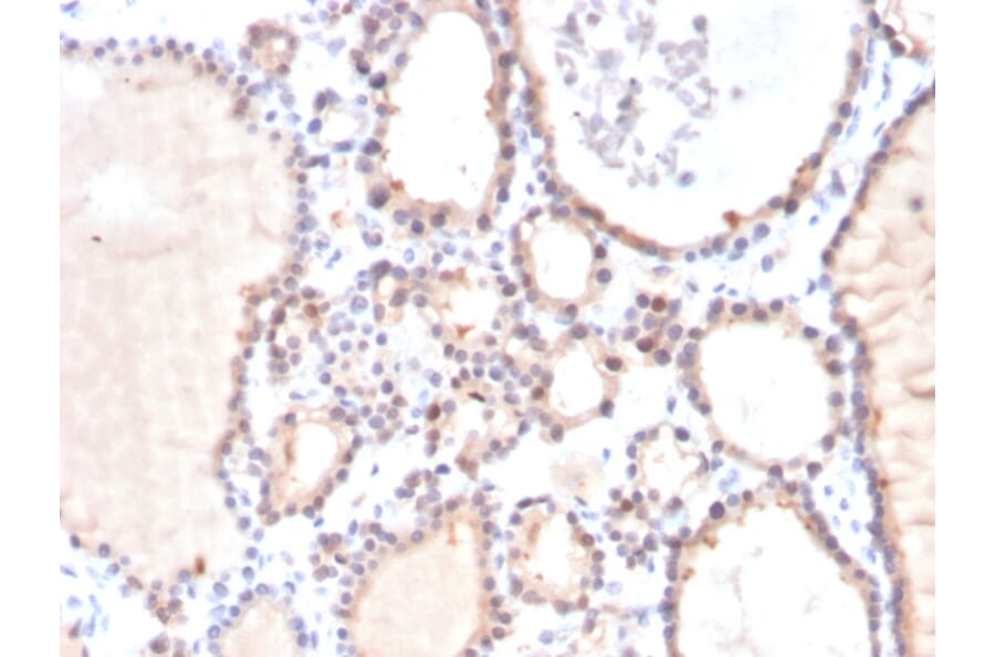 Immunohistochemistry - Anti-Glyoxalase 1 Antibody [CPTC-GLO1-3] - BSA and Azide free (A251922) - Antibodies.com
