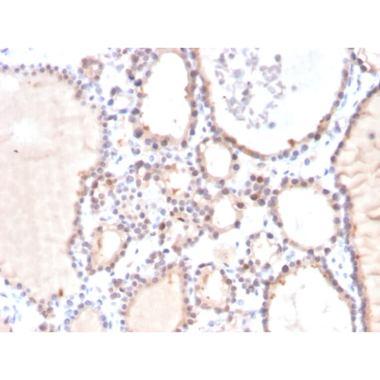 Immunohistochemistry - Anti-Glyoxalase 1 Antibody [CPTC-GLO1-3] - BSA and Azide free (A251922) - Antibodies.com