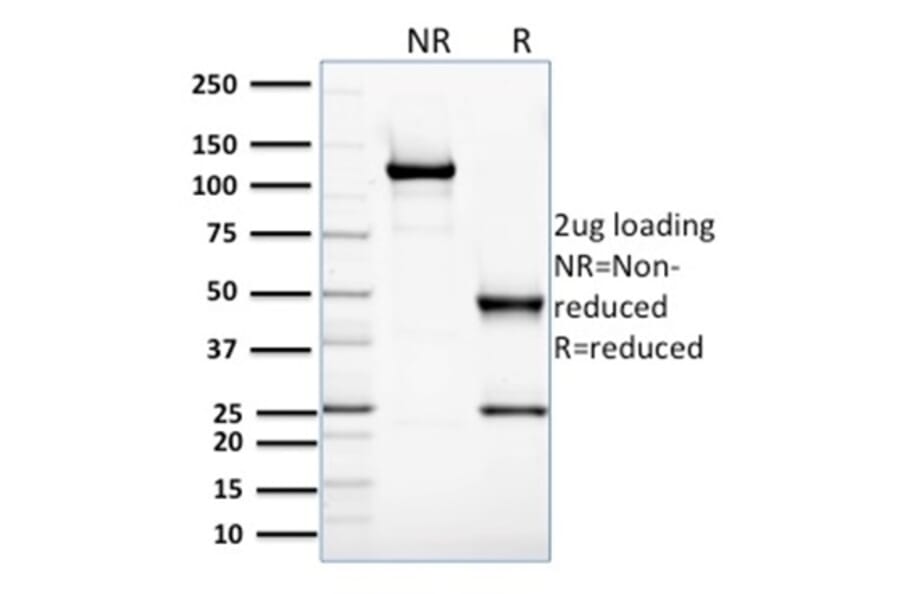 SDS-PAGE - Anti-Glyoxalase 1 Antibody [CPTC-GLO1-3] - BSA and Azide free (A251922) - Antibodies.com