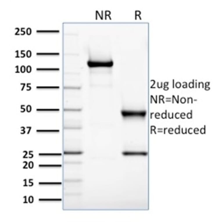 SDS-PAGE - Anti-Glyoxalase 1 Antibody [CPTC-GLO1-3] - BSA and Azide free (A251922) - Antibodies.com