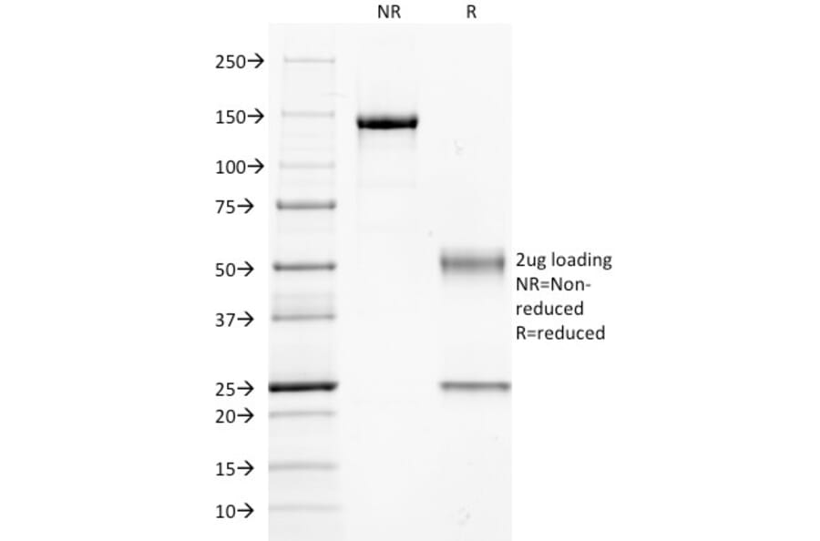 SDS-PAGE - Anti-GNAQ Antibody [GNAQ/2434] - BSA and Azide free (A251922) - Antibodies.com