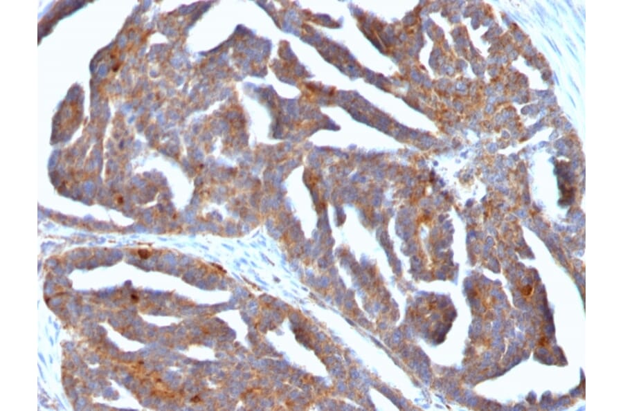 Immunohistochemistry - Anti-GnRHR Antibody [F1G4] - BSA and Azide free (A251924) - Antibodies.com