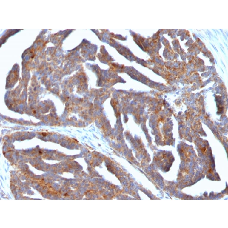 Immunohistochemistry - Anti-GnRHR Antibody [F1G4] - BSA and Azide free (A251924) - Antibodies.com