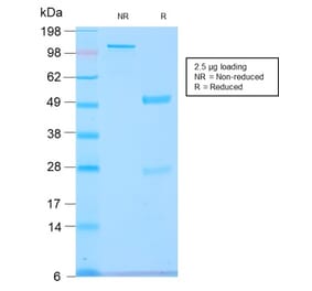 SDS-PAGE - Anti-GnRHR Antibody [GNRHR/2982R] - BSA and Azide free (A251926) - Antibodies.com