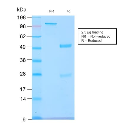 SDS-PAGE - Anti-GnRHR Antibody [GNRHR/2982R] - BSA and Azide free (A251926) - Antibodies.com