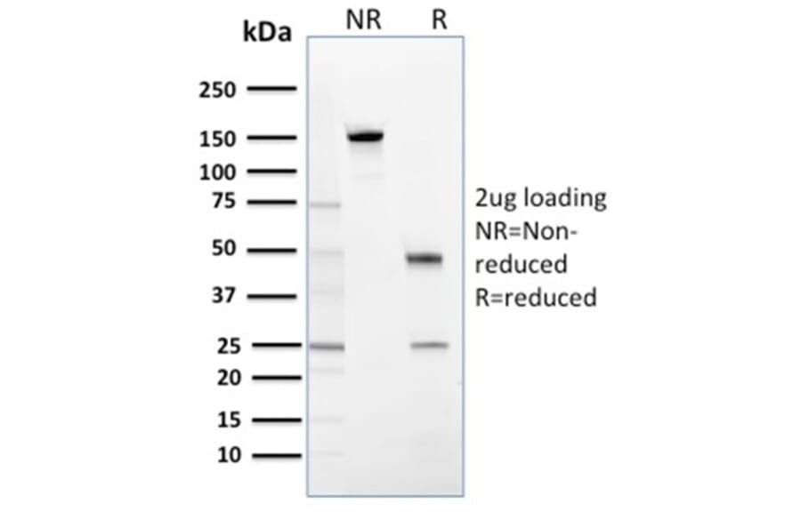 SDS-PAGE - Anti-14-3-3 Sigma Antibody [CPTC-SFN-2] - BSA and Azide free (A251928) - Antibodies.com