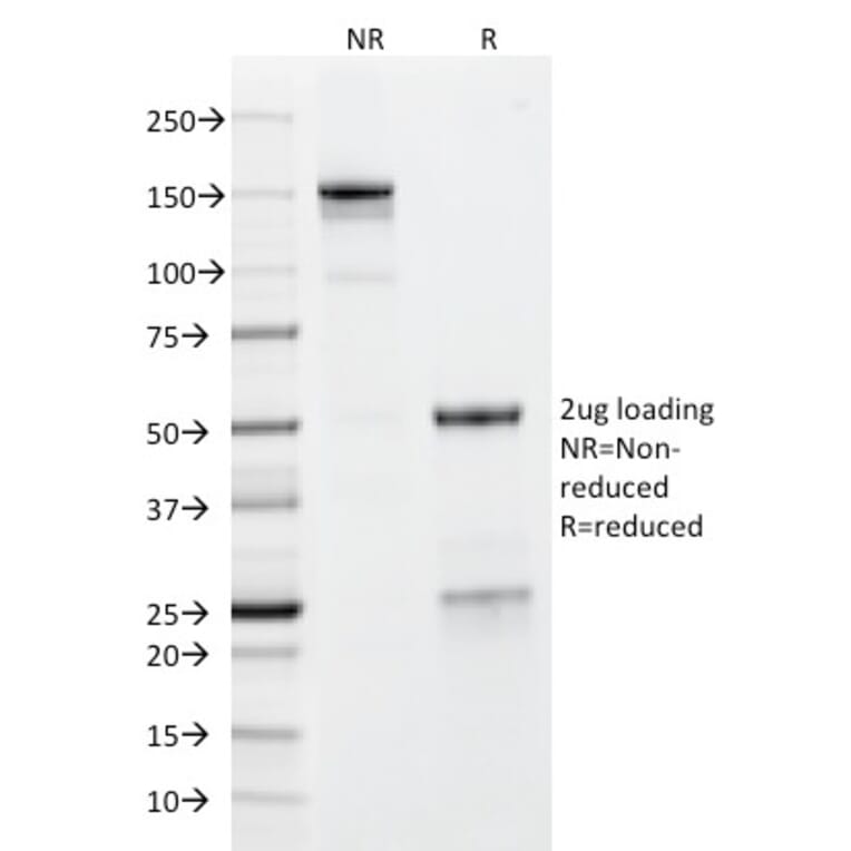 SDS-PAGE - Anti-Glycoprotein 2 Antibody [GP2/1712] - BSA and Azide free (A251929) - Antibodies.com
