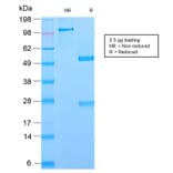 SDS-PAGE - Anti-Glycoprotein 2 Antibody [GP2/2569R] - BSA and Azide free (A251931) - Antibodies.com