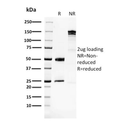 SDS-PAGE - Anti-Glucose 6 Phosphate Isomerase Antibody [CPTC-GPI-1] - BSA and Azide free (A251933) - Antibodies.com