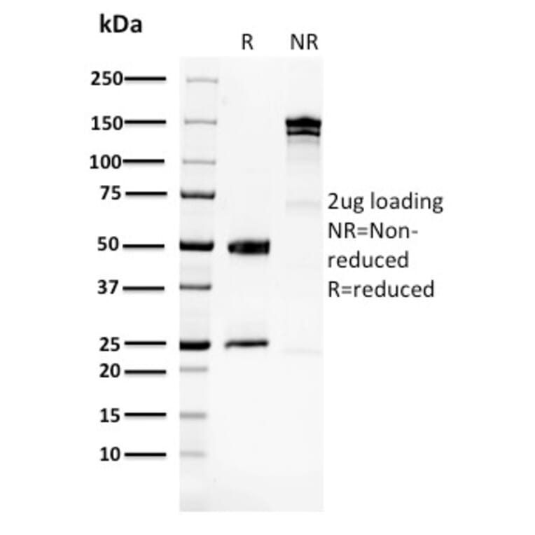 SDS-PAGE - Anti-Glucose 6 Phosphate Isomerase Antibody [CPTC-GPI-1] - BSA and Azide free (A251933) - Antibodies.com