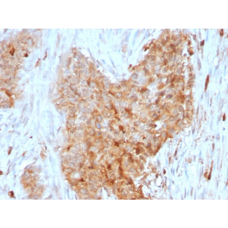 Immunohistochemistry - Anti-Glucose 6 Phosphate Isomerase Antibody [CPTC-GPI-1] - BSA and Azide free (A251933) - Antibodies.com