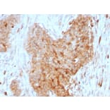 Immunohistochemistry - Anti-Glucose 6 Phosphate Isomerase Antibody [CPTC-GPI-1] - BSA and Azide free (A251933) - Antibodies.com